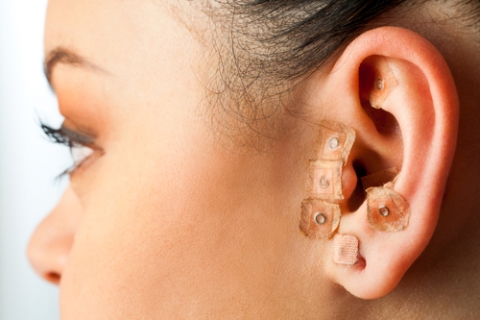 auriculoterapia
