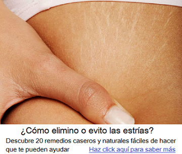remedios para las estrías