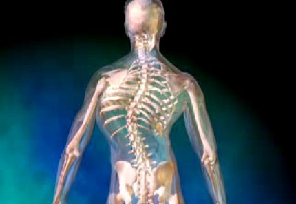 escoliosis
