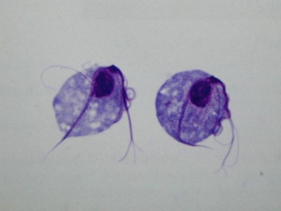 remedios tricomoniasis