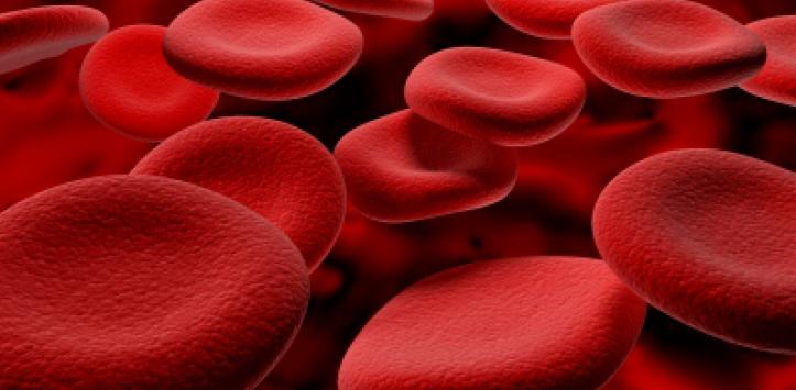 exceso de hierro en la sangre