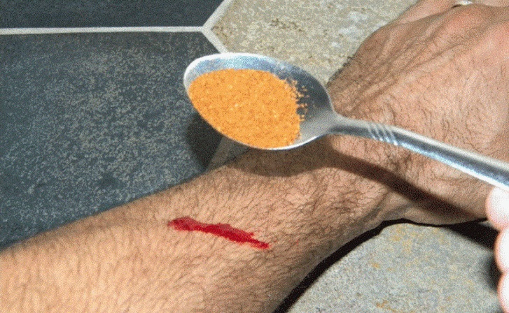 remedios para deterner la sangre de una herida
