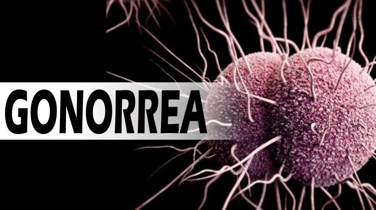 remedios para la gonorrea
