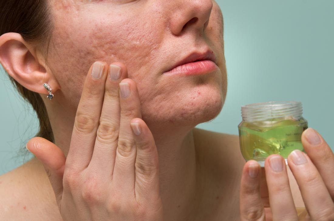 aceite de jojoba