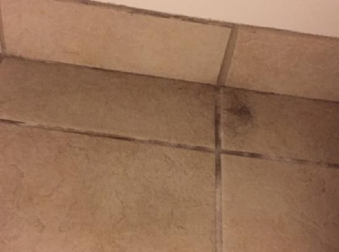 que significa encontrar pelos en todos lados
